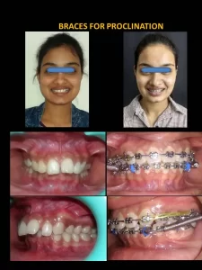 patient work