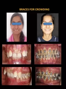 patient work